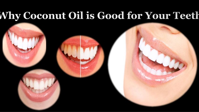 coconut oil is useful for teeths also
